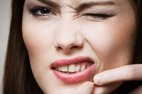 6 cách đơn giản làm mờ vết thâm sau mụn hiệu quả